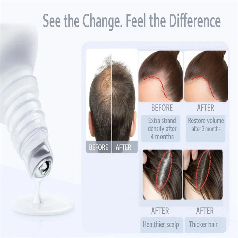 Advanced Hair Roll-On – Be Bodywise with Rosemary & Redensyl, Scalp Care