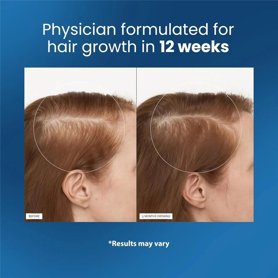Advanced Hair Roll-On – Be Bodywise with Rosemary & Redensyl, Scalp Care